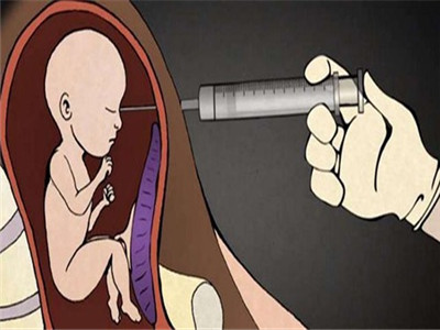 怀孕三个月做人流还是引产?引产的危害