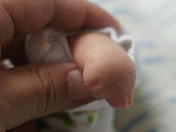 孕妈产子后竟发现宝宝没有手指，知道真相后泣不成声！