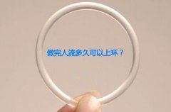 做完人流可以直接上环吗?【3大女性上环的注意事项】