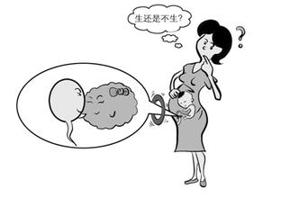 【提问】带环怀孕孩子能要吗？医生建议要从这2点考虑..