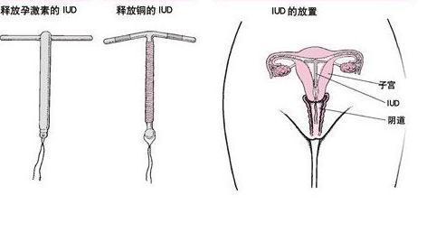 上环的***佳时间│超详细的5种时期的上环***佳时间!