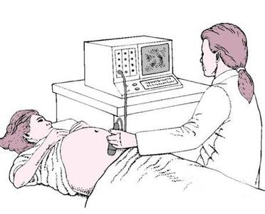 一般怀孕多久能测出来_【科普】4种测早孕方法的时间!